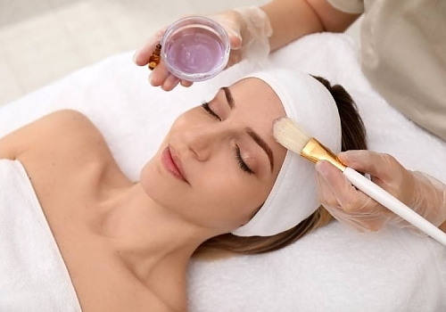 Post-Peel Care: Nurturing Your Skin After a Chemical Peel